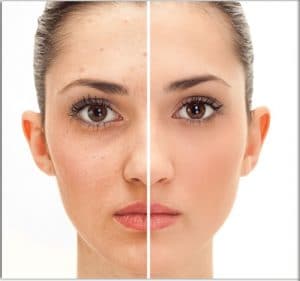 botox tunisie : améliorer l'aspect de votre visage