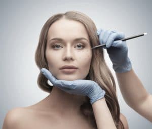 lifting-medio-facial