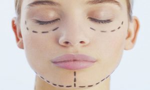 lifting-medio-facial-prix